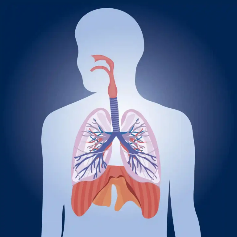 기관지 확장증 (bronchiectasis)