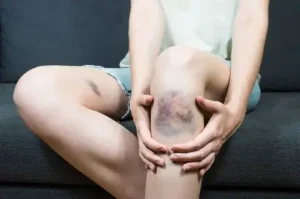 면역성 혈소판 감소성 자반증